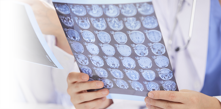  氧化鋁打印介質吸附劑